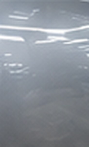 Close-up of the dent in the BMW's door